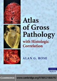 Imagen de portada: Atlas of Gross Pathology 9780521868792