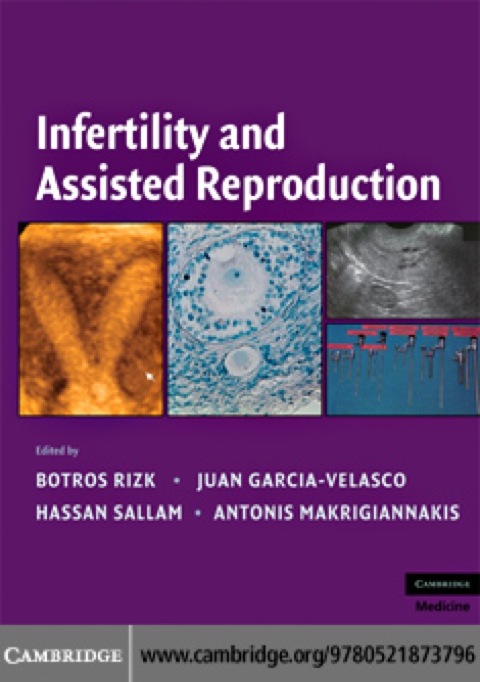 Infertility and Assisted Reproduction, 1st Edition - FULL INSTANT DOWNLOAD | PDF DOCX EPUB