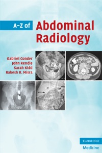 صورة الغلاف: A-Z of Abdominal Radiology 9780521700146