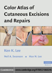Omslagafbeelding: Color Atlas of Cutaneous Excisions and Repairs 1st edition 9780521860246