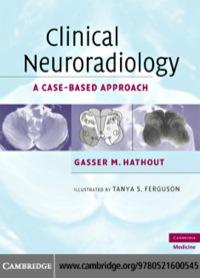 表紙画像: Clinical Neuroradiology 1st edition 9780521600545