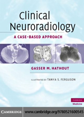 Cover image: Clinical Neuroradiology 1st edition 9780521600545