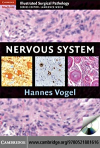 Cover image: Nervous System 1st edition 9780521881616