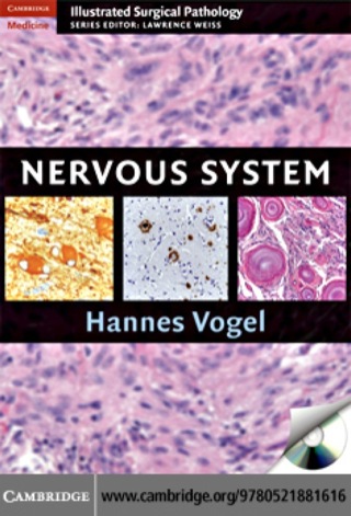 Cover image: Nervous System 1st edition 9780521881616