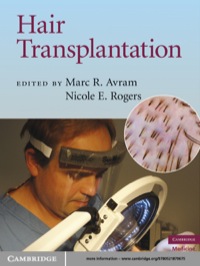 Cover image: Hair Transplantation 1st edition 9780521879675