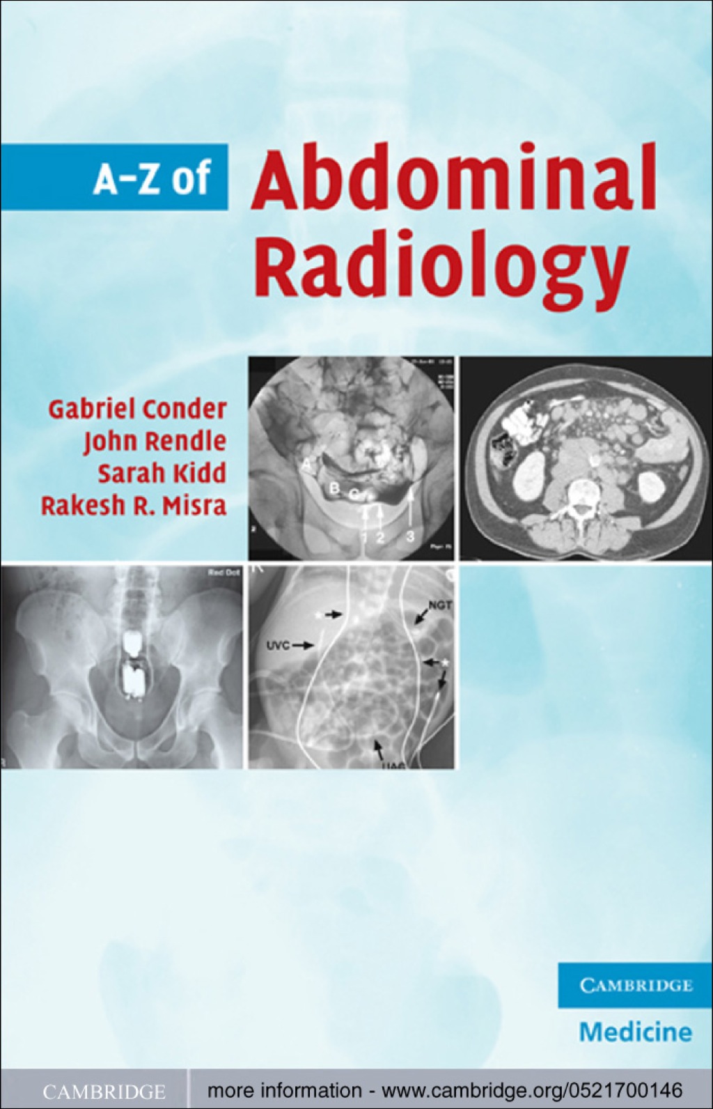 A-Z of Abdominal Radiology 1st Edition