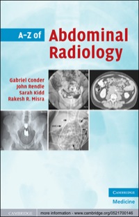 Cover image: A-Z of Abdominal Radiology 1st edition 9780521700146