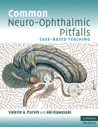 Titelbild: Common Neuro-Ophthalmic Pitfalls 1st edition 9780521713269