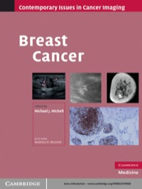Immagine di copertina: Breast Cancer 1st edition 9780521519502