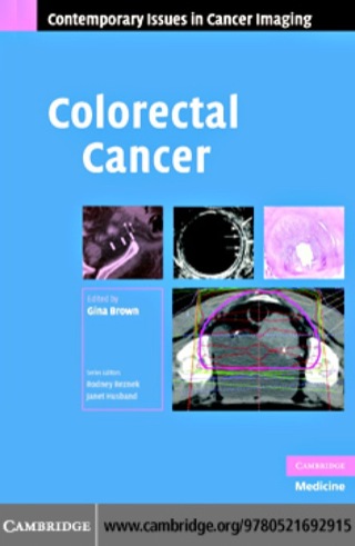 Cover image: Colorectal Cancer 1st edition 9780521692915