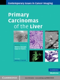 Cover image: Primary Carcinomas of the Liver 1st edition 9780521519519