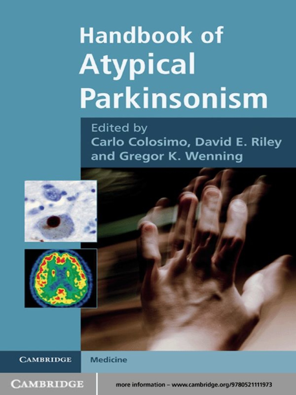 Handbook of Atypical Parkinsonism 1st Edition