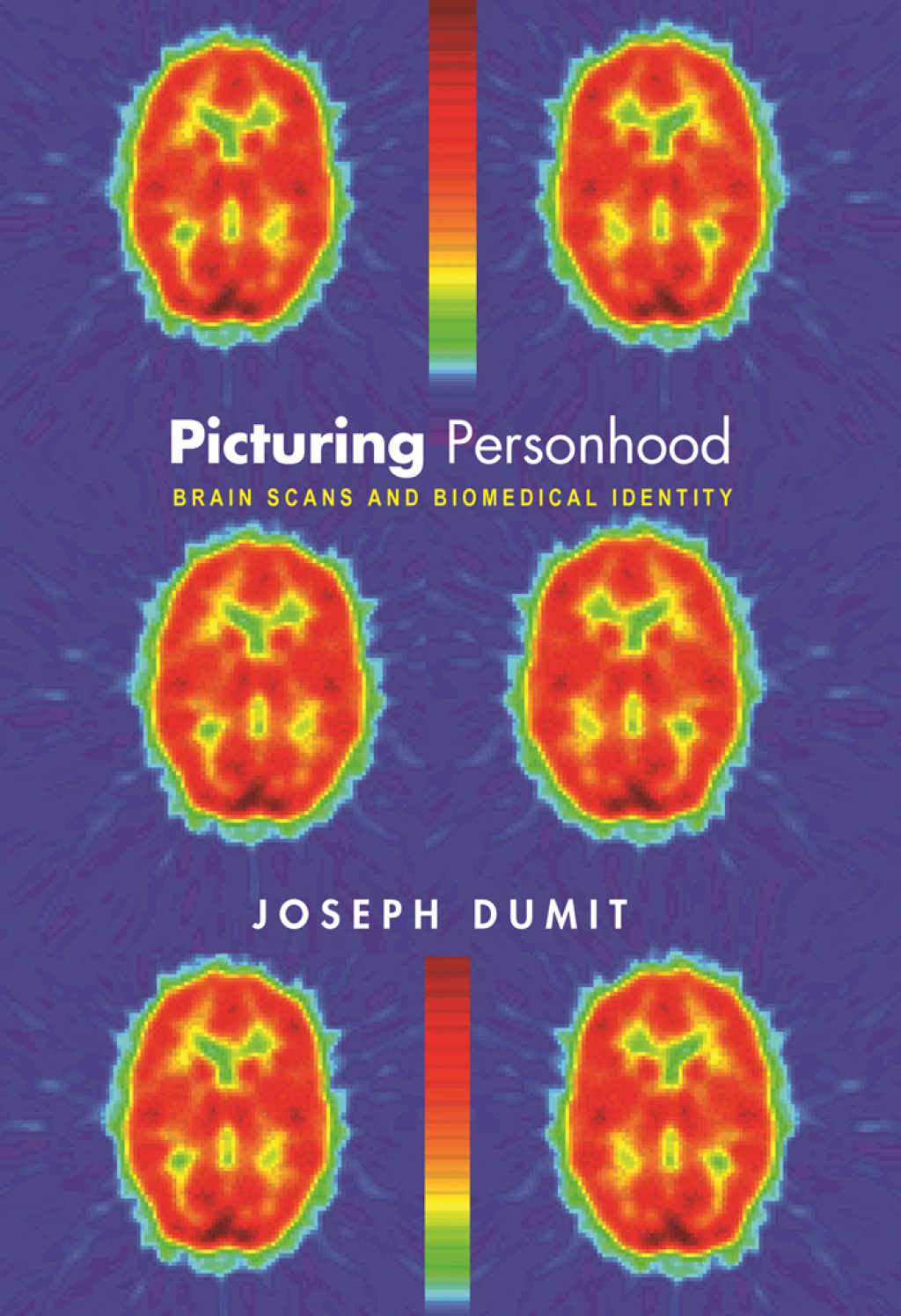 Picturing Personhood Brain Scans and Biomedical Identity
