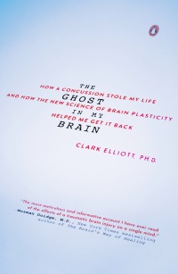 Cover image: The Ghost in My Brain 9780525426561