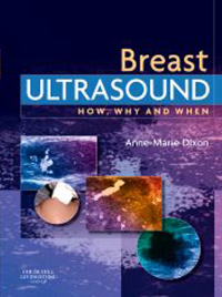 Cover image: E-Book - Breast Ultrasound 9780443100765