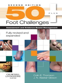 Imagen de portada: 50 Foot Challenges 2nd edition 9780443104022