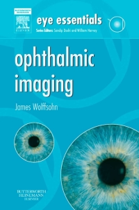 Omslagafbeelding: Eye Essentials: Ophthalmic Imaging 9780750688574