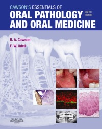 Cover image: Cawson's Essentials of Oral Pathology and Oral Medicine 8th edition 9780443101250