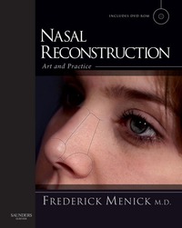 Cover image: Nasal Reconstruction: Art and Practice 9780702030086