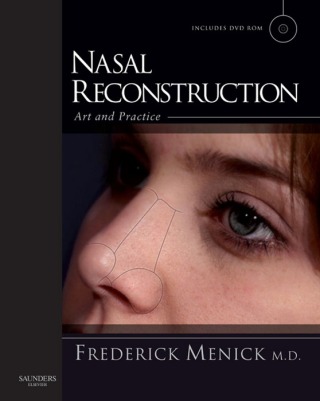 Cover image: Nasal Reconstruction: Art and Practice 9780702030086