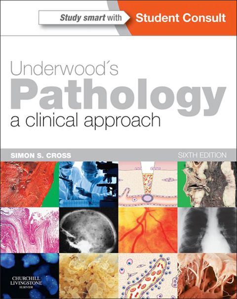 Underwood's Pathology: A Clinical Approach, 6th Edition - FULL INSTANT DOWNLOAD | PDF DOCX EPUB