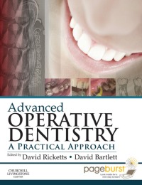 Cover image: Advanced Operative Dentistry 9780702055386