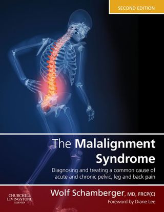 表紙画像: The Malalignment Syndrome 2nd edition 9780443069291
