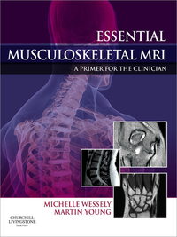 Omslagafbeelding: Essential Musculoskeletal MRI 9780443067266