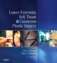 Imagen de portada: Lower Extremity Soft Tissue & Cutaneous Plastic Surgery 9780702045448