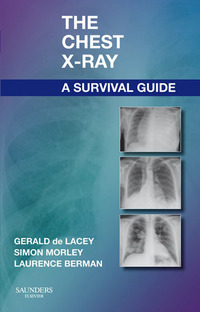 صورة الغلاف: The Chest X-Ray: A Survival Guide 9780702030468