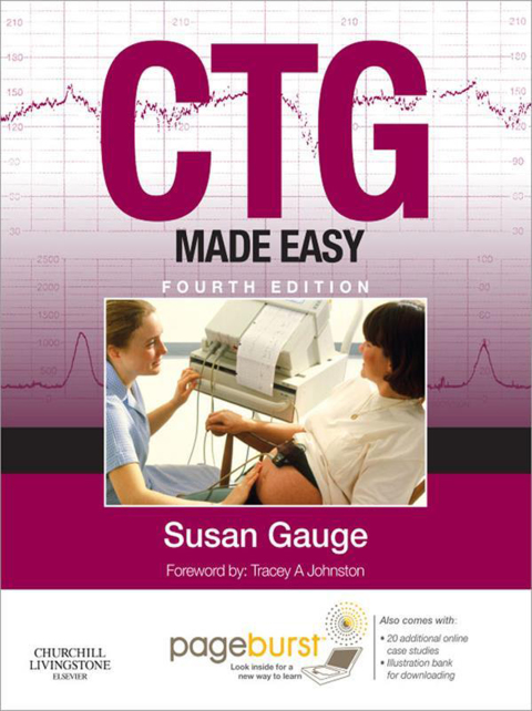 CTG Made Easy (Revised), 4th Edition - FULL INSTANT DOWNLOAD | PDF DOCX EPUB