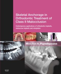 Imagen de portada: Skeletal Anchorage in Orthodontic Treatment of Class II Malocclusion 9780723436492