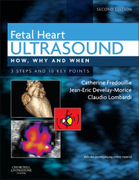 Titelbild: Fetal Heart Ultrasound 2nd edition 9780702043413