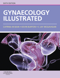 Cover image: Gynaecology Illustrated 6th edition 9780702030673