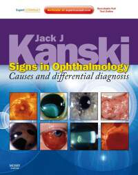 صورة الغلاف: Signs in Ophthalmology: Causes and Differential Diagnosis - Electronic 1st edition 9780723435488