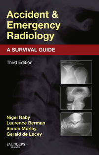 表紙画像: Accident and Emergency Radiology: A Survival Guide 3rd edition 9780702042324