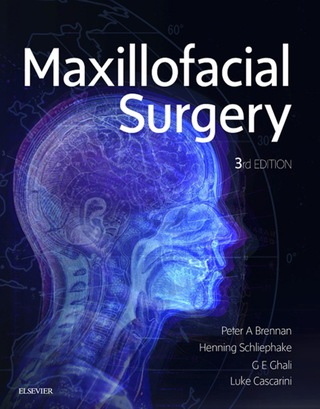 表紙画像: Maxillofacial Surgery 3rd edition 9780702060564