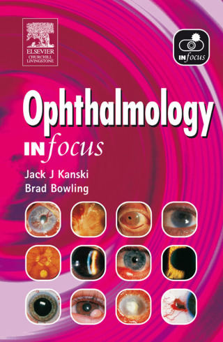 Cover image: Ophthalmology In Focus 9780443100307