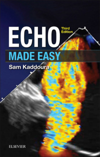 Imagen de portada: Echo Made Easy - Electronic 3rd edition 9780702066566