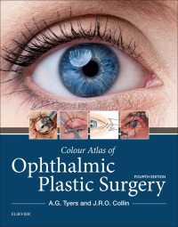 表紙画像: Colour Atlas of Ophthalmic Plastic Surgery 4th edition 9780323476799