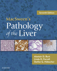 Titelbild: MacSween's Pathology of the Liver 7th edition 9780702066979