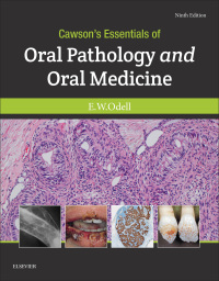 Omslagafbeelding: Cawson's Essentials of Oral Pathology and Oral Medicine 9th edition 9780702049828