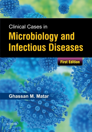 Immagine di copertina: Clinical Cases in Microbiology and Infectious Diseases 1st edition 9780702074172