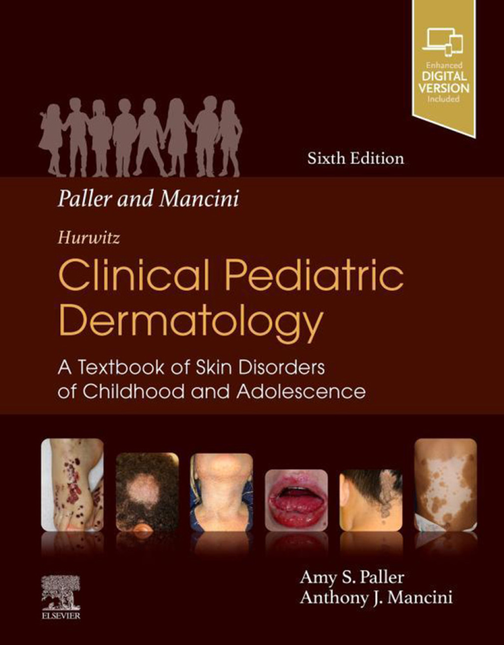 Paller and Mancini – Hurwitz Clinical Pediatric Dermatology A Textbook of Skin Disorders of Childhood and Adolescence 6th Edition