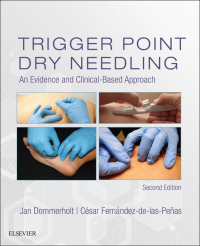 Cover image: Trigger Point Dry Needling 2nd edition 9780702074165