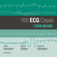Immagine di copertina: 150 ECG Cases 5th edition 9780702074585