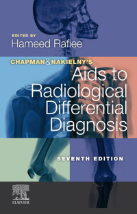 Titelbild: Chapman & Nakielny's Aids to Radiological Differential Diagnosis 7th edition 9780702075391