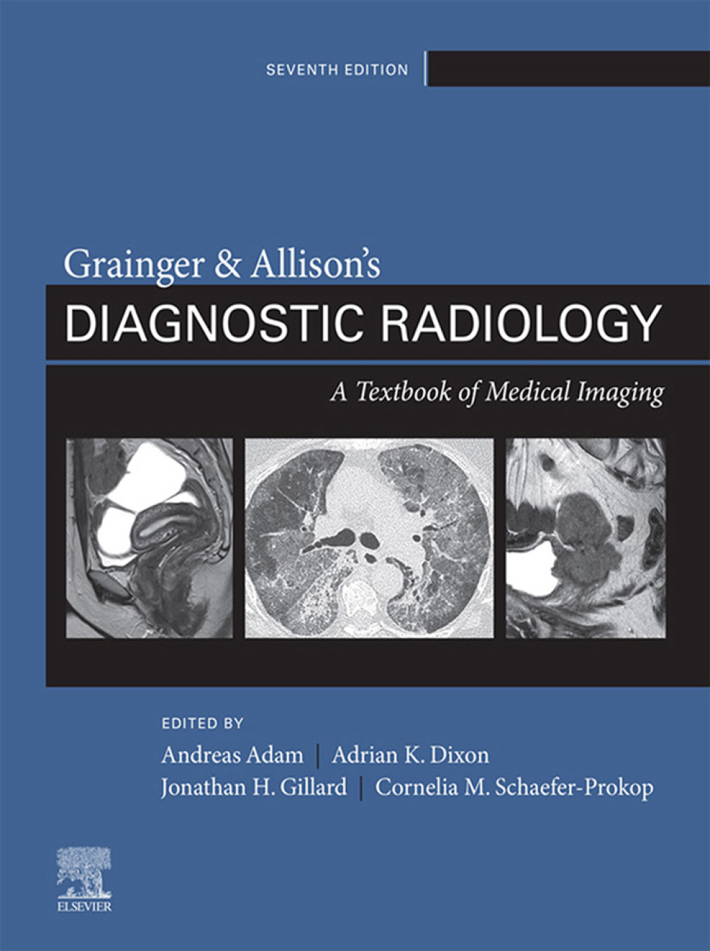 Grainger & Allison’s Diagnostic Radiology 7th Edition