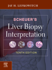 Imagen de portada: Scheuer's Liver Biopsy Interpretation 10th edition 9780702075841