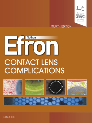 Cover image: Contact Lens  Complications 4th edition 9780702076114